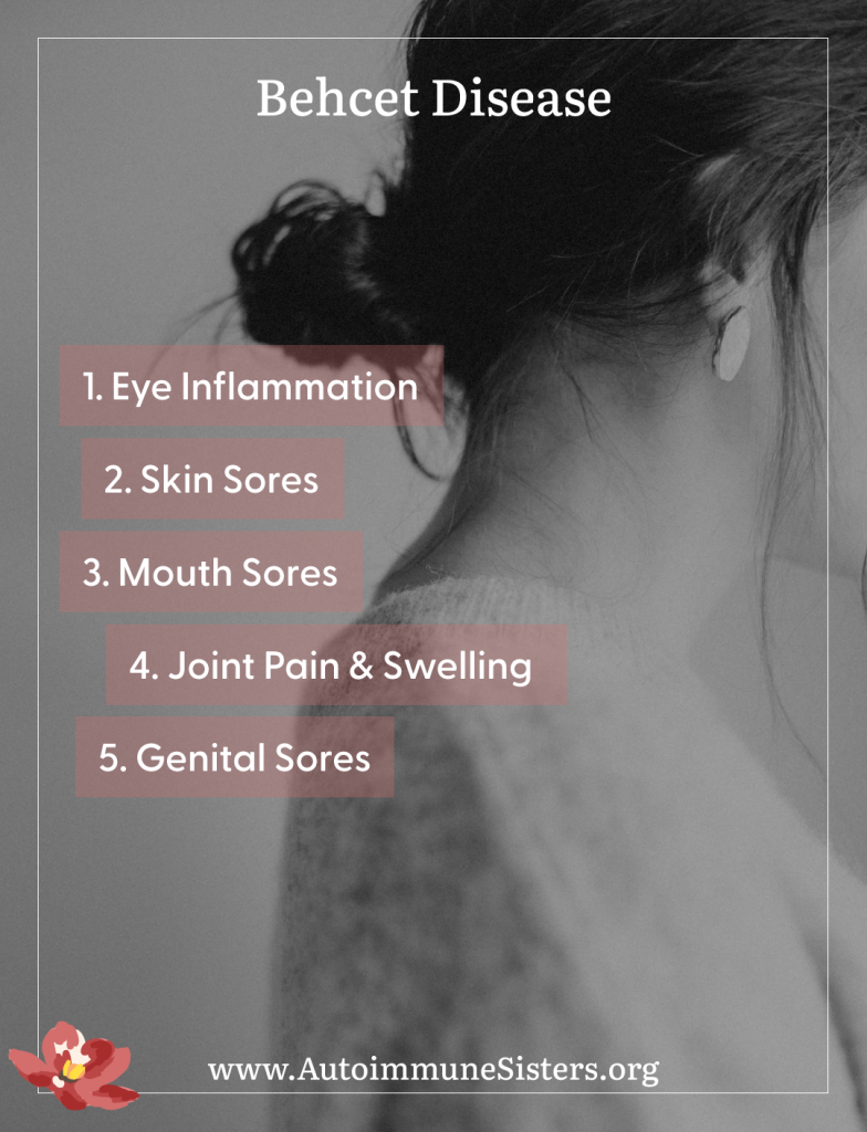 behcet disease