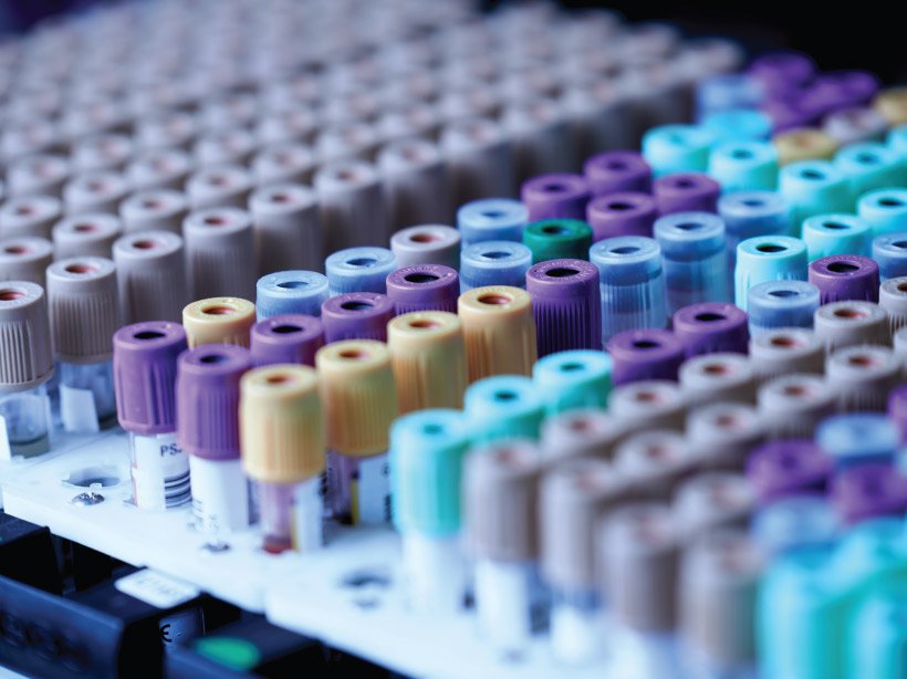 lab tests