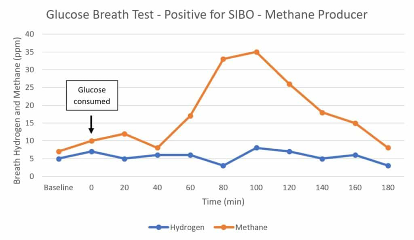sibo breath test