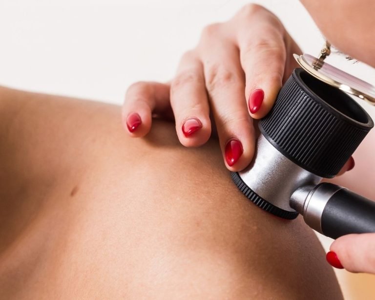 Skin Cancer and Autoimmunity